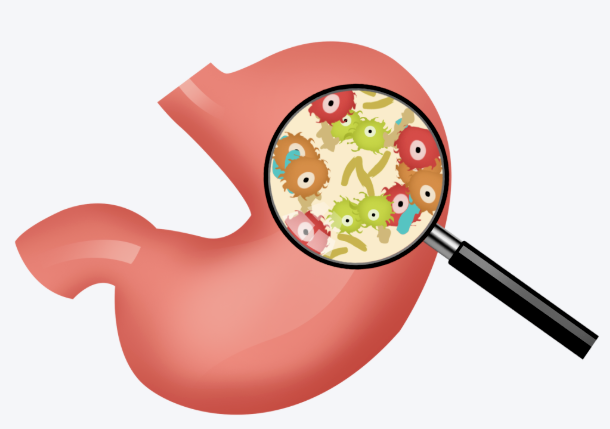 重视胃肠镜检查，筑牢肿瘤筛查防线